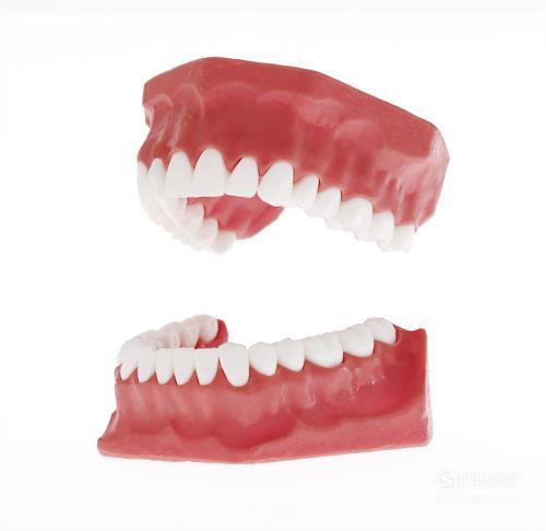 矫正期间牙龈增生怎么办？