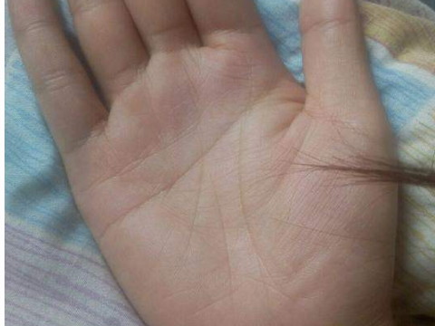 手掌算命手上的杂色图案有多好