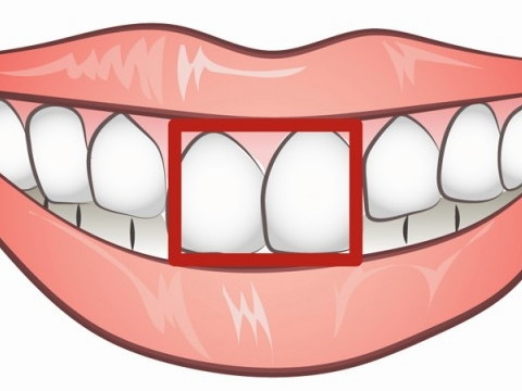 梦见掉了两颗门牙