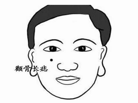 左边颧骨上有痣的男人的插图