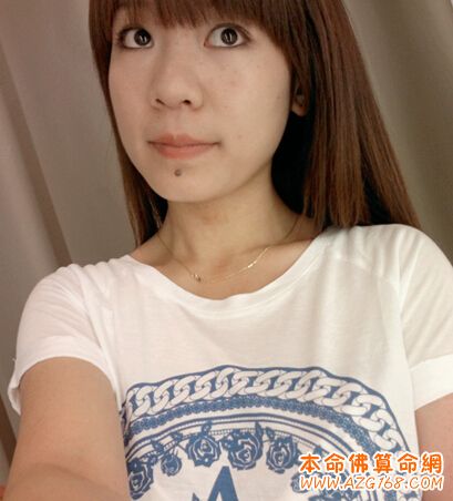 女人下巴长痣好不好