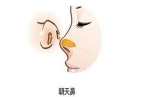 面向天空的命运是什么