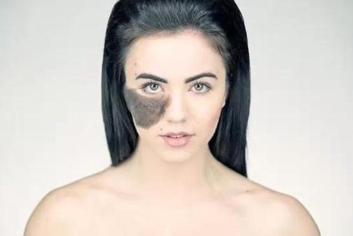 胎记怎么算命？