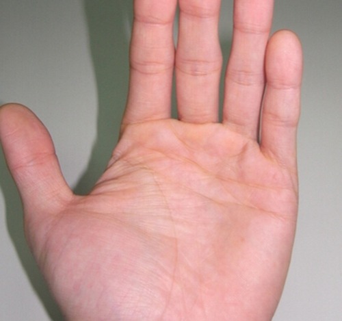 手掌颜色红运气吉凶