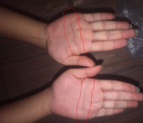 双手断掌的男人命运