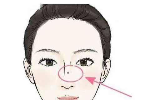 鼻子上有痣的女人怎么样