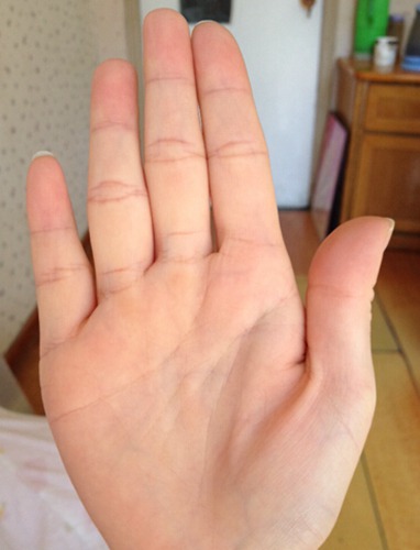 周易手相看健康状况