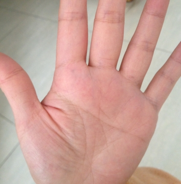 手相切割的优缺点