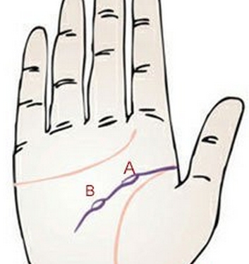 智慧线中的岛屿图案说明了什么