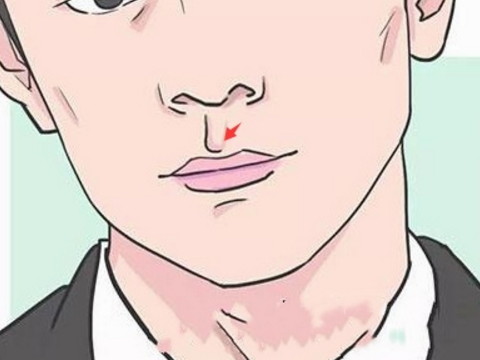 人中长痣的男人命运如何