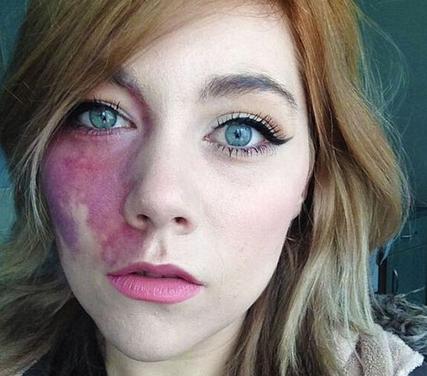 胎记算命胎记位置看命运