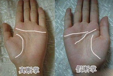 一个人摔断掌好吗