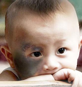 青色胎记青色胎记算命