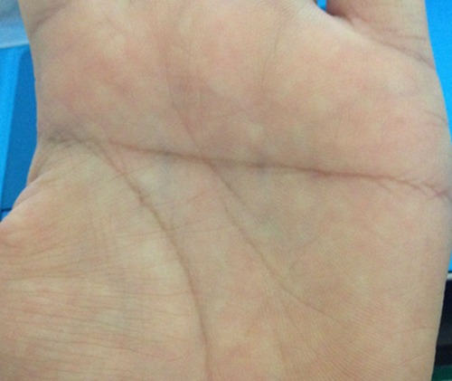 如何辨别真假断掌