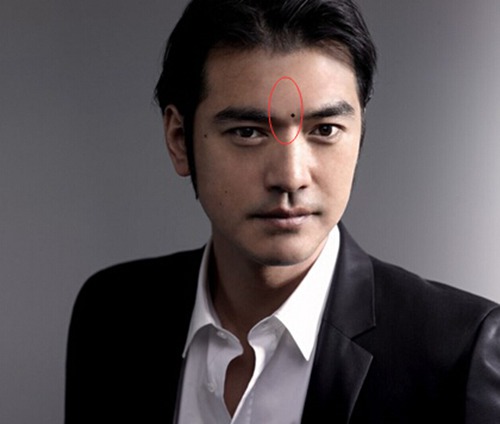 男人印堂有痣代表什么