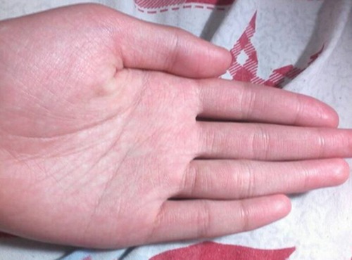 手掌颜色与健康图解