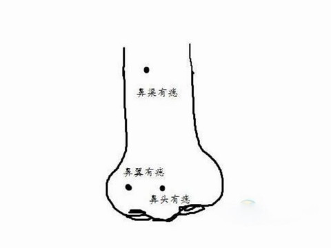 女性鼻子上痣的插图