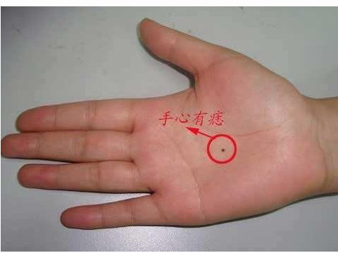 一个手掌上有痣的人是什么意思