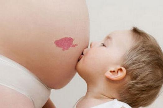 胎记的位置表明命运是好是坏