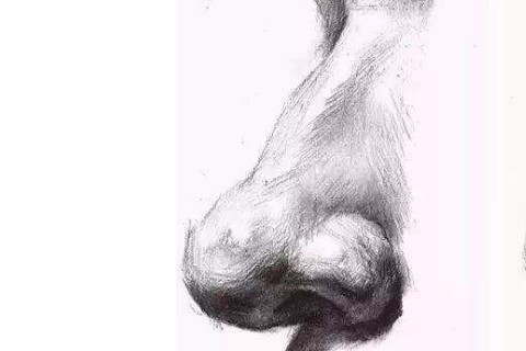 鼻子上有个疤，好吗