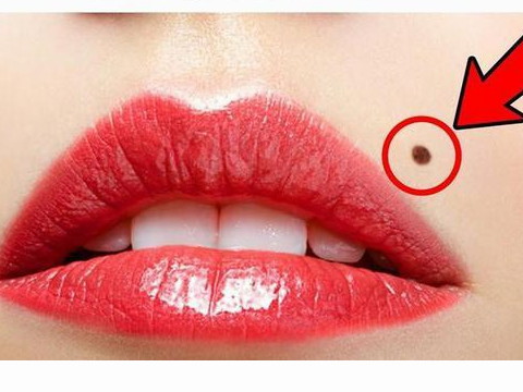 离婚痣相 女人容易离婚的痣相