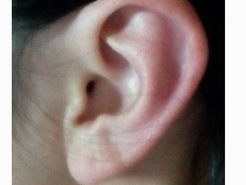 你怎么看耳垂