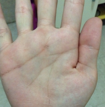 智慧线短了会怎么样