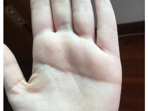 左手骨折的男生聪明吗