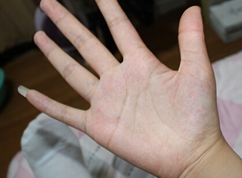 智慧线与生命线相交