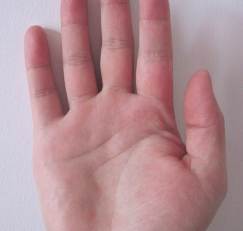 看手相的智慧线看你是否聪明